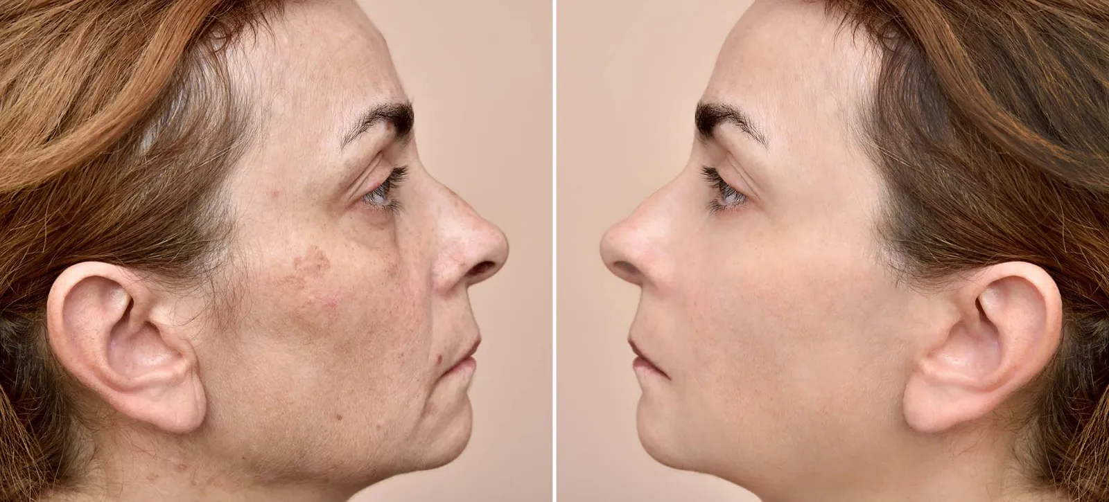 A set of two portraits of the same woman, one before and the other after applying make-up and removing eye bags. Beauty treatment concept.