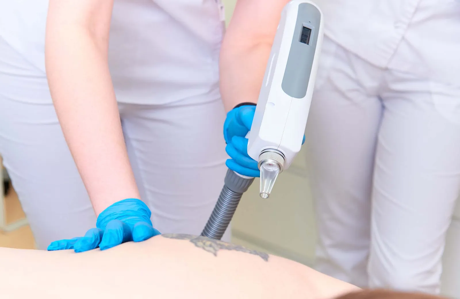 Procedure removal tattoo in laser cosmetology clinic.