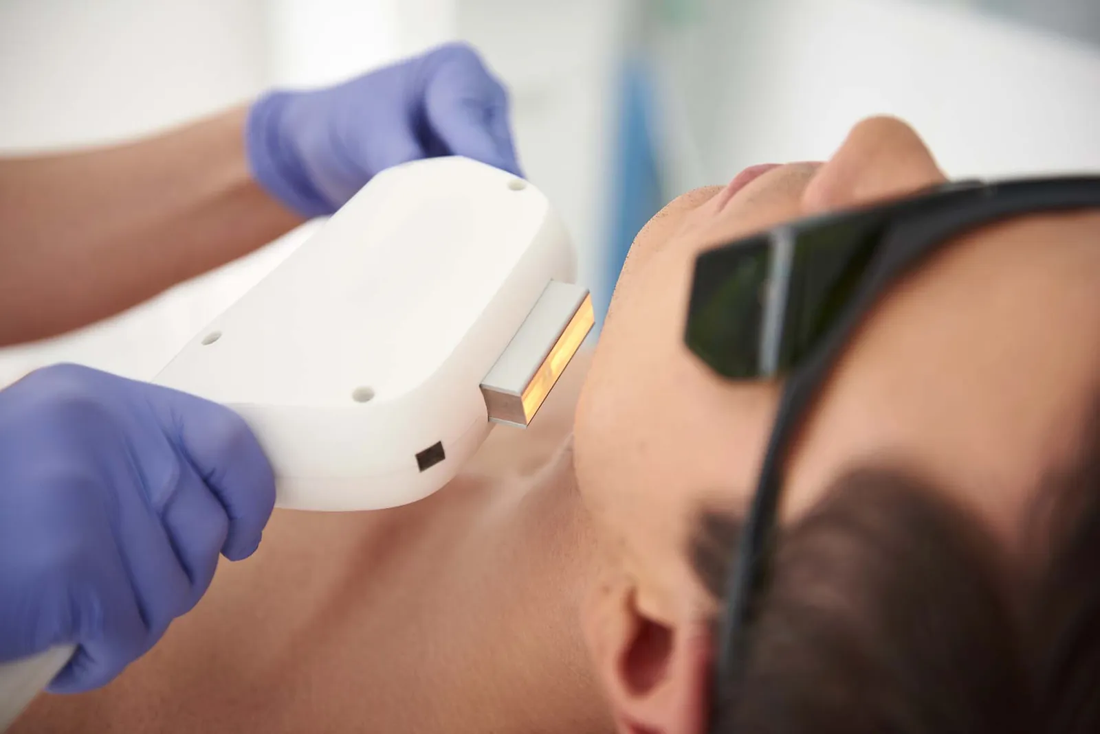 Close up of laser epilation procedure of man